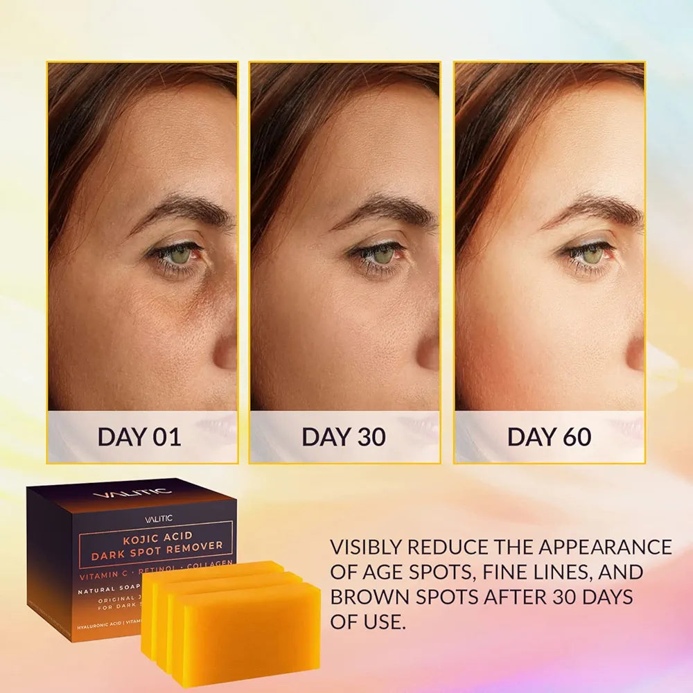 VALITIC Kojic Acid Dark Spot Remover Soap. Original Japanese Complex