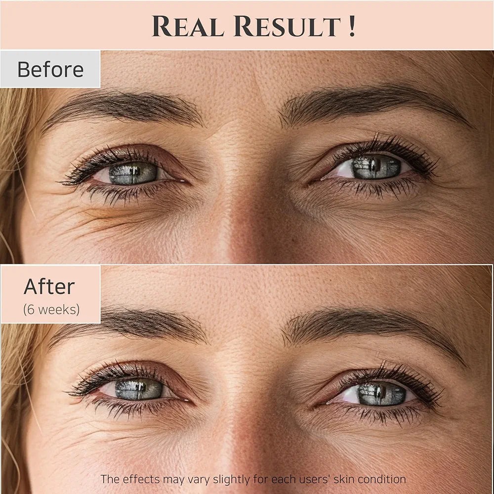 Beauty of Joseon Revive Eye Serum For Puffy Eye Bags, Fine Lines, Dark Circles and Wrinkles