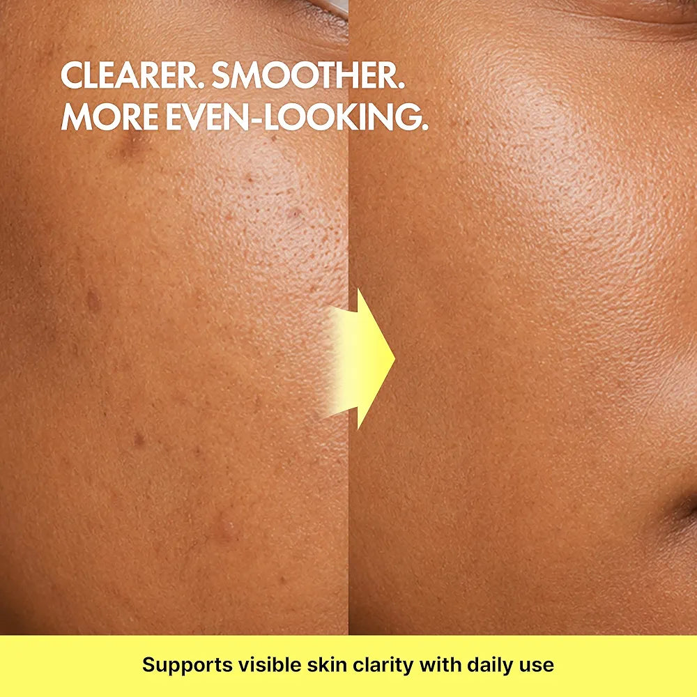 TIAM Vita B3 Source Serum | 10% Niacinamide + 2% Arbutin Dark Spot & Tone Correcting Serum