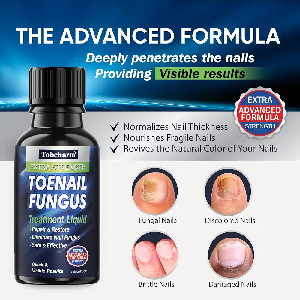 Tobcharm Toenail Fungus Treatment | Extra Strength