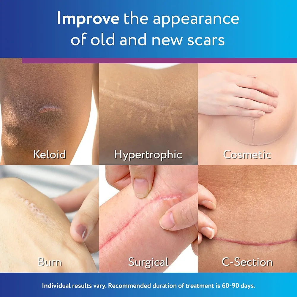 ScarAway Silicone Scar Gel | For Keloid & Hypertrophic Scars | Improves Size, Colour & Texture | 10g