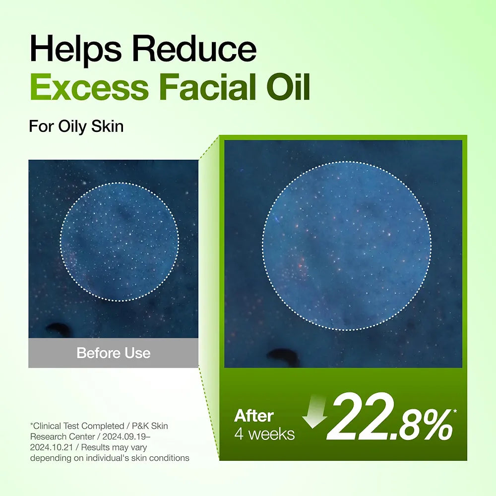 Anua Azelaic Acid 10 Hyaluron Redness Soothing Serum 30ml – Acne, Redness & Blemish Serum