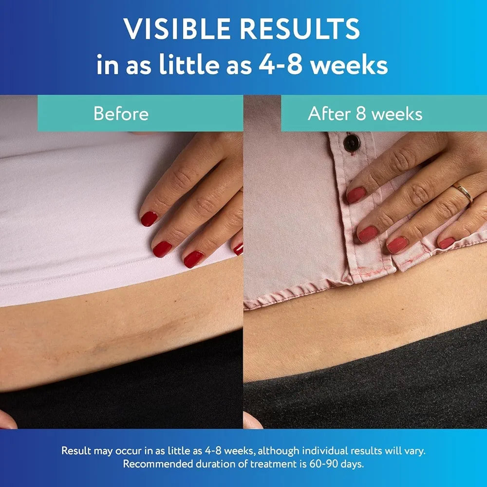 ScarAway Advanced Clear Silicone Scar Sheets | Medical-Grade for Surgical, Burn, Body, Hypertrophic & Keloid Scar Treatment & Prevention