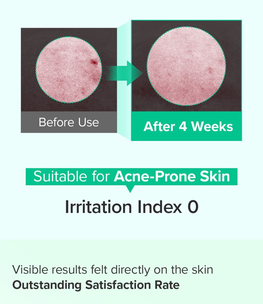 Mary&May Spicule Azelaic PDRN Spot Cream Set | Acne, Dark Spot & Pore Care 15g