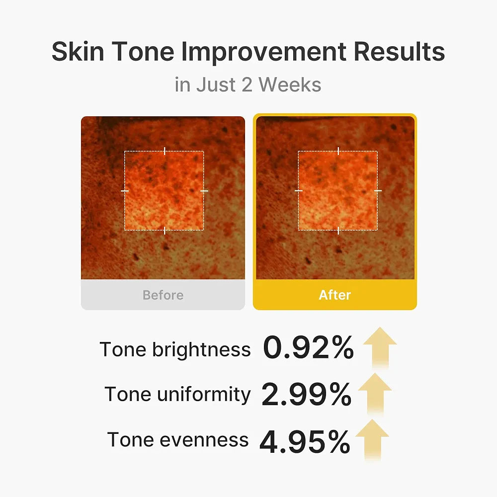 Medicube Kojic Acid Turmeric Vita Capsule Cream for Dark Spots, Hyperpigmentation & Uneven Skin Tone