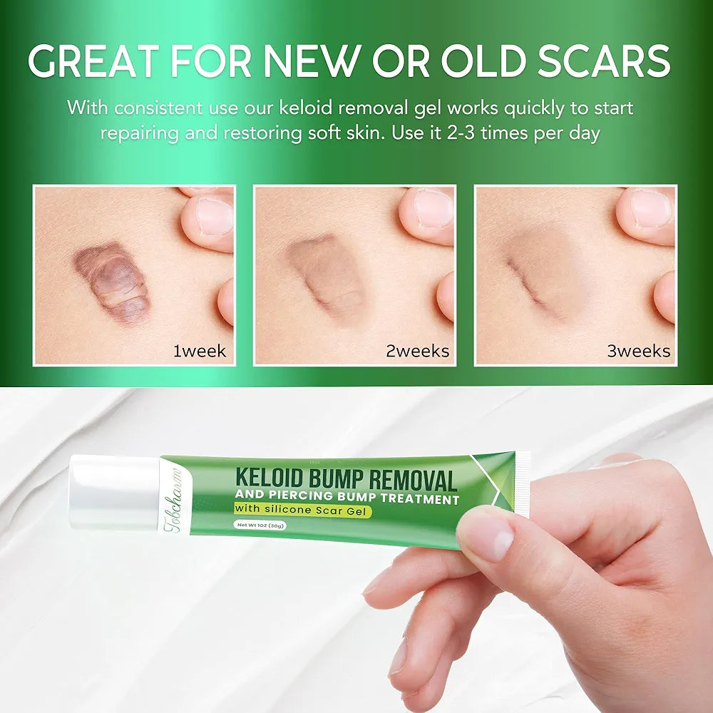 Tobcharm Advanced Keloid Bump Removal Gel