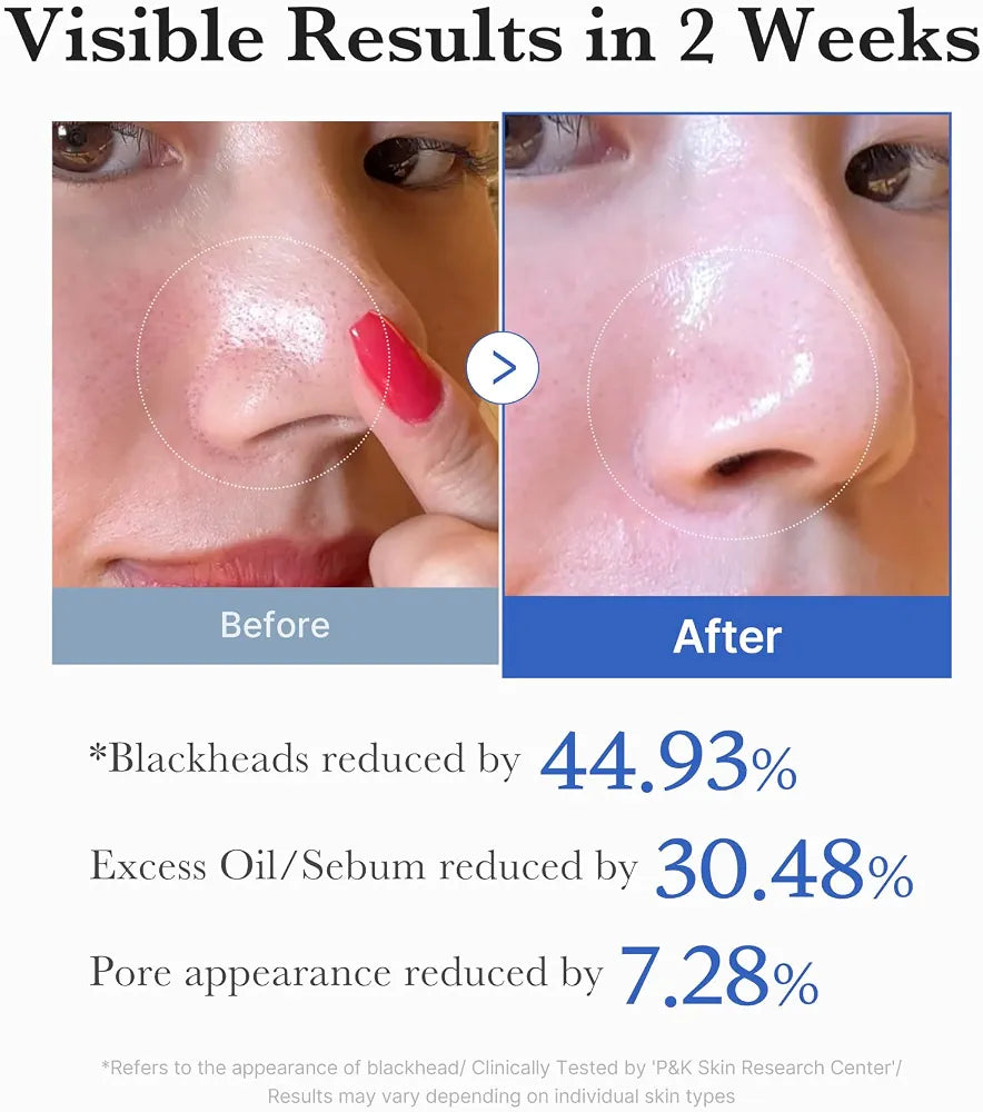Medicube Zero Pore Pad 2.0 with AHA & BHA for Enlarged Pores, Blackheads, Excess Oil & Uneven Skin Texture, 70 Pads
