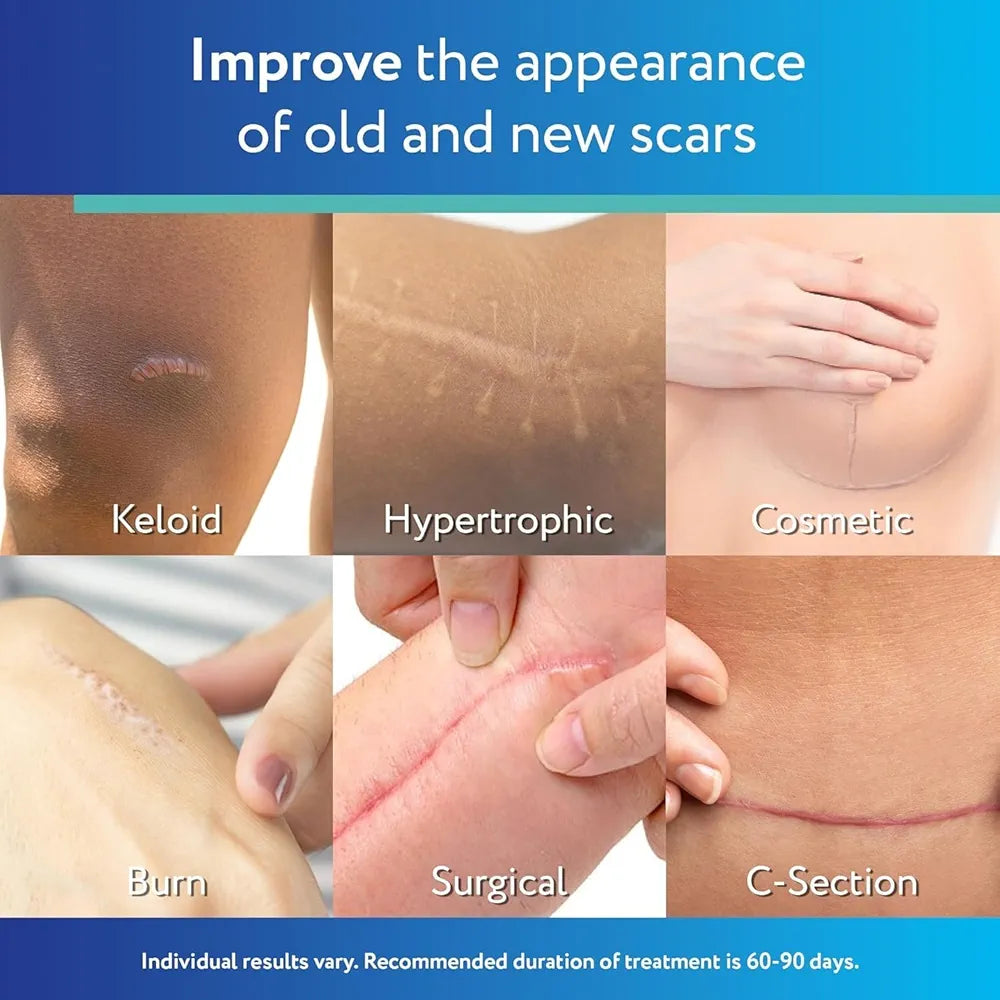 ScarAway Advanced Clear Silicone Scar Sheets | Medical-Grade for Surgical, Burn, Body, Hypertrophic & Keloid Scar Treatment & Prevention