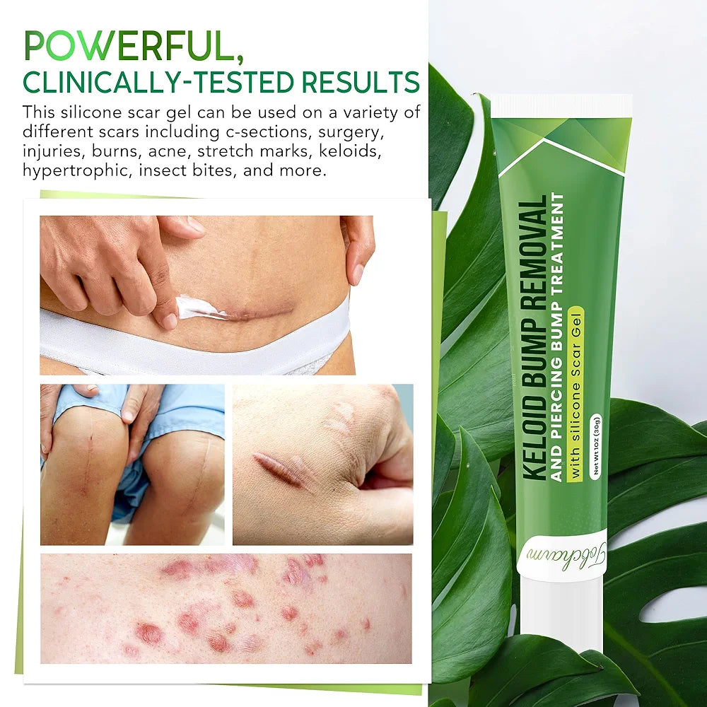 Tobcharm Advanced Keloid Bump Removal Gel