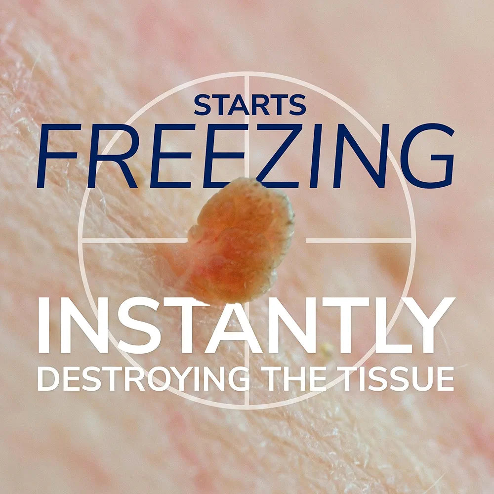 Dr. Scholl's Freeze Away Skin Tag Remover Kit | Completely removes Skin Tags in 1 Treatment, FDA-Cleared & Clinically Proven At-Home Removal with Permanent Results